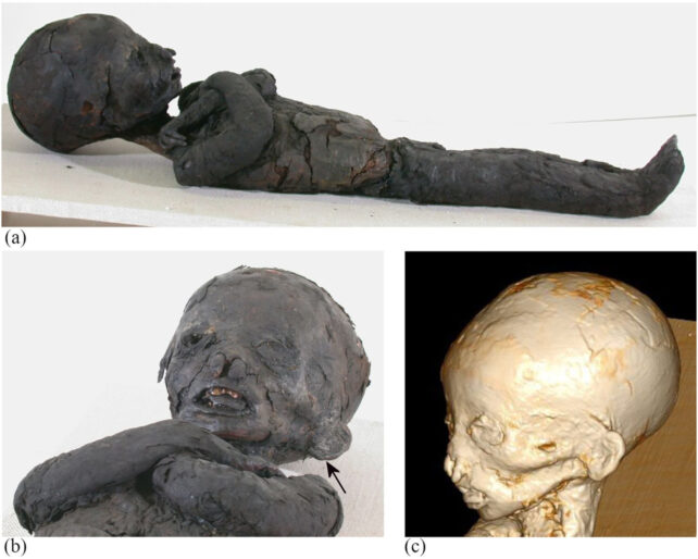 (a) Photograph showing a mummy in supine position with the arms crossed upon the mid-chest. Remnants of textile wrappings are preserved on the upper and lower extremities as well as on the torso. Note the dark- colored skin and textiles caused by embalming substances. The skull of the child is elongated. (b) Detailed photograph and (c) 3D volume rendering CT reconstruction of the head