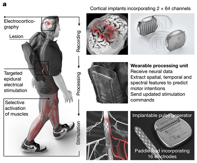 Brain-Spine Interface diagram