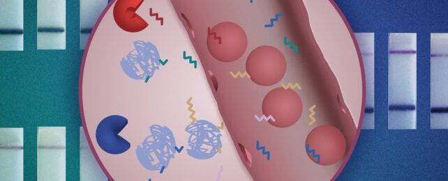 Nanoparticle sensor in the blood
