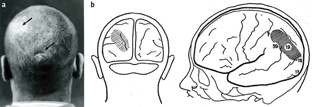 Brain diagram