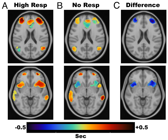 Brain scans