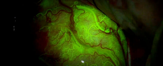 green dyed blood vessels in the brain on a black background