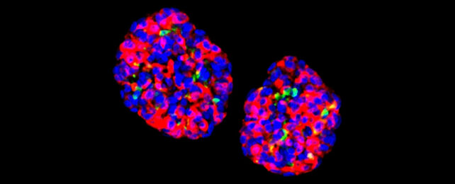 Gastric insulin-secreting (GINS) cells