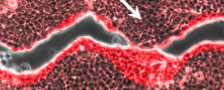 Zig-Zag Cuts Heal Differently to Straight Incisions, And Now We Know ...