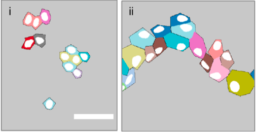 Two grey shares have coloured cells in them showing the placement of the cell nucleus as a white dot. On the left the nuclei are centred in cells but on the right the cells are forming a bridge over a wound and the nuclei are placed on the cell edges. 