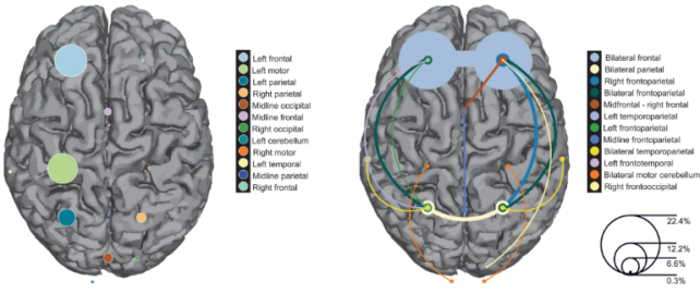 El estudio más grande que muestra que la estimulación eléctrica mejora la función cerebral: ScienceAlert