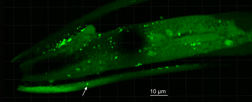 fluorescent green image of inside a worm's head with bright dots indicating aggregates