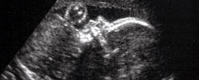 Doctors Conduct Brain Surgery on Fetus in Womb in World First