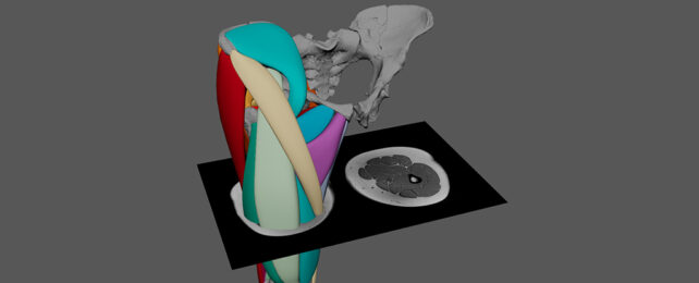 Muscle cross section