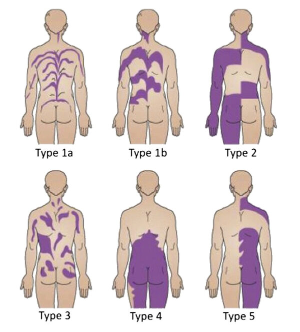 Humans Actually Have Secret Stripes And Other Strange Markings ...
