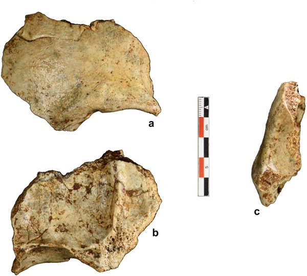 Piece of skull bone photographed from multiple angles.