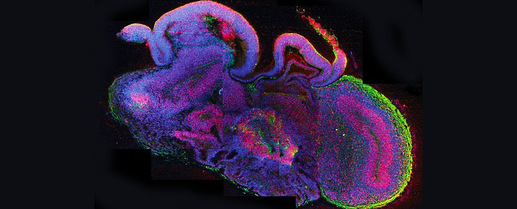 cerebral brain organoid