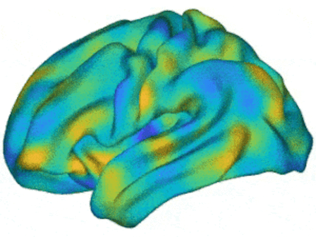 Animation of colored patterns moving across a brain.
