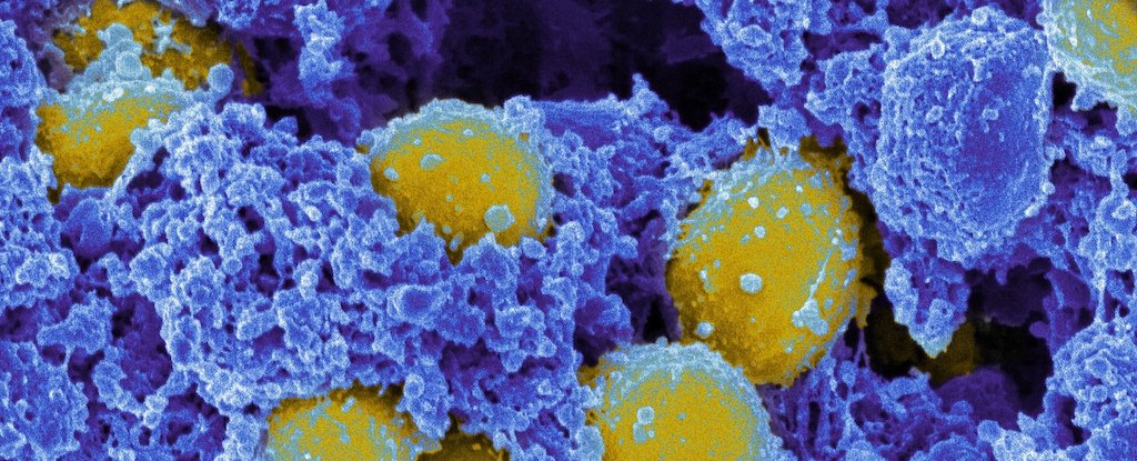 Los científicos acaban de descubrir cómo esta superbacteria mortal se esconde dentro de nosotros : Heaven32