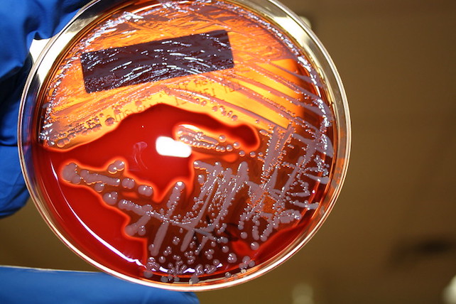 golden staph bacteria in petri dish