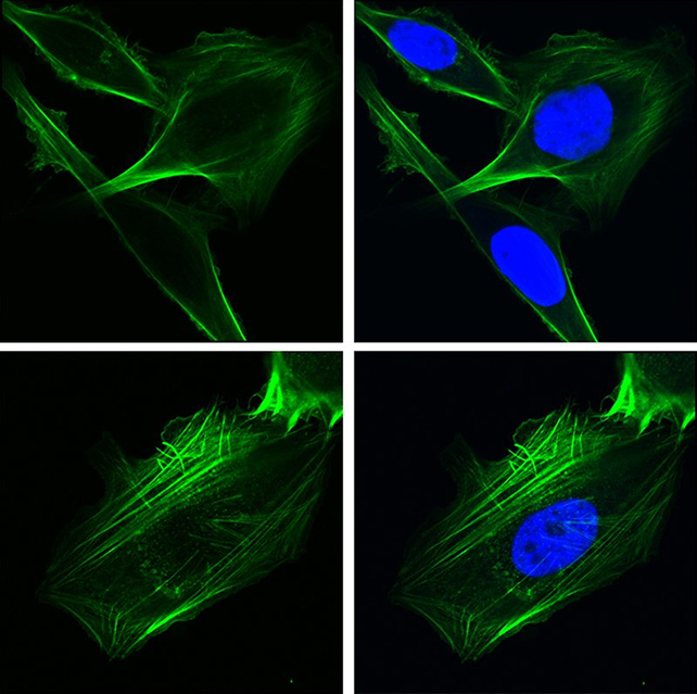 Cancer cells