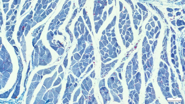 Cells in a cross section of cardiac tissue 