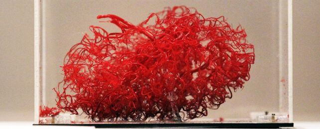 Blood vessels of the brain