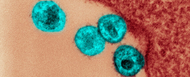 electron microscope images of hiv particles falsely coloured blue