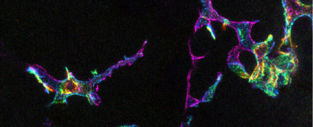 Microscopy image of immune cells in human cornea.