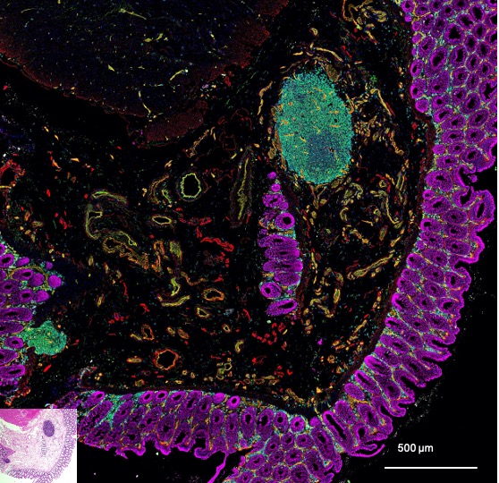 Fluorescent microscopy image of intestinal wall with insert of a typical histology section, for comparison.