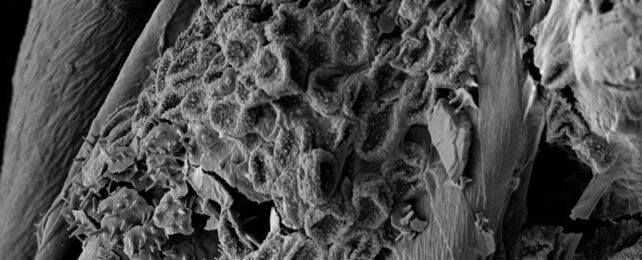 Microscope Close Up Of Decomposing Body