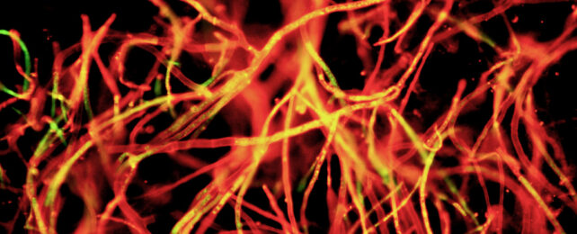 Fluorescent microscope image of filamentous mycelium stained red.