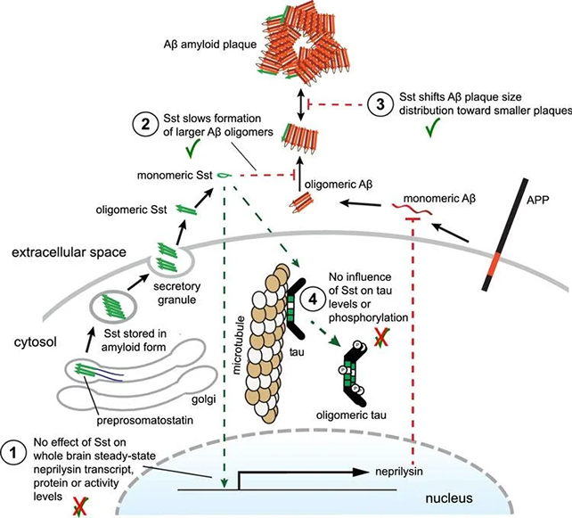 Alzheimer's plaque diagram