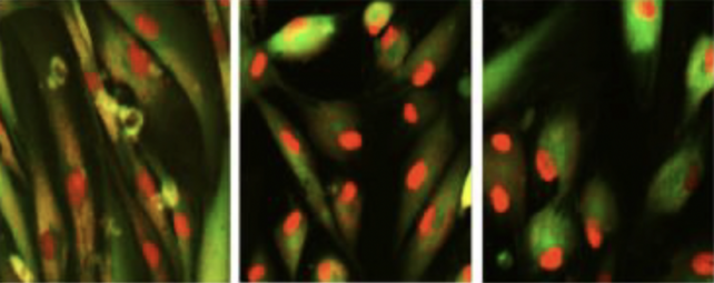 Three microscope images of cells