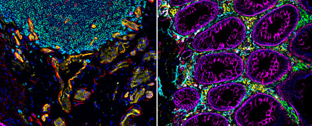 Two fluorescent microscope images of intestine tissue samples.