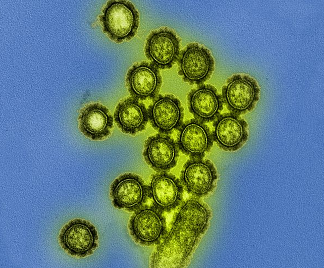electron micrograph image of h1n1 particles