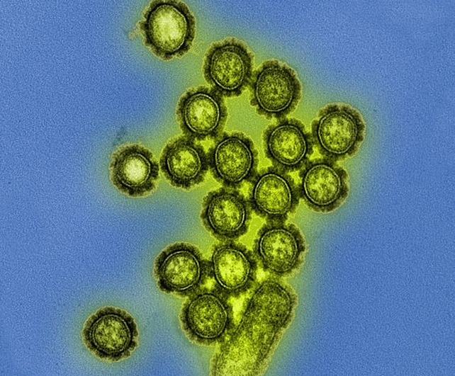 h1n1 parçacıklarının elektron mikrografı görüntüsü