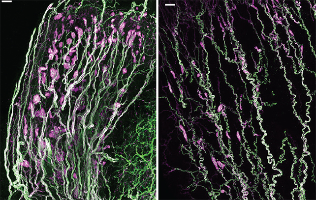 stained slides of neural tissue comparing clitoris and penis tissues