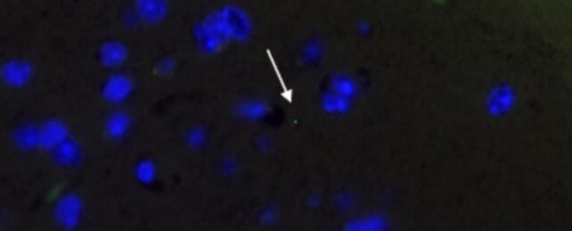 Microplastics Infiltrate Every Organ, Including Brain, Study in Mice Shows