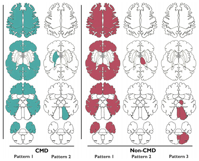 Brain scans