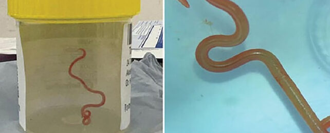 Left: A petri dish with worm inside. Right: worm in blue background