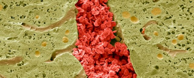 A scanning electron micrograph of a section through a vein in the liver, showing red blood cells surrounded by hepatocytes (green)