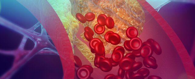 Illustration of blood cells in artery clogged by fat.