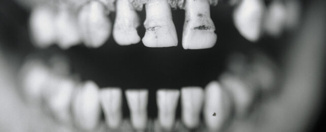 Human teeth