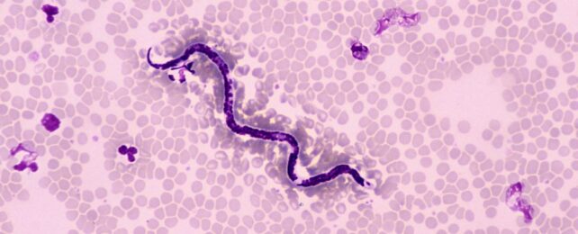 Radical Trial Shows Hookworms May Protect People From Type 2 Diabetes