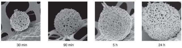 Black and white scanning electron microscopy images of spherical protein condensates.