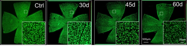 Four images of cells with magnified insets showing decreasing numbers over time. 