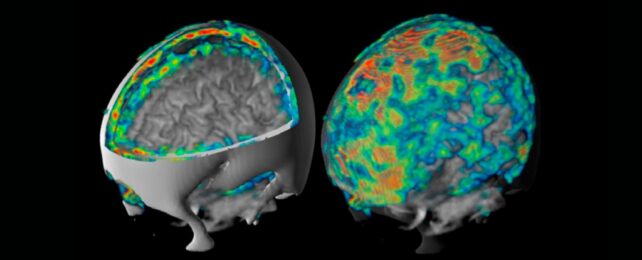 Two PET images of the brain