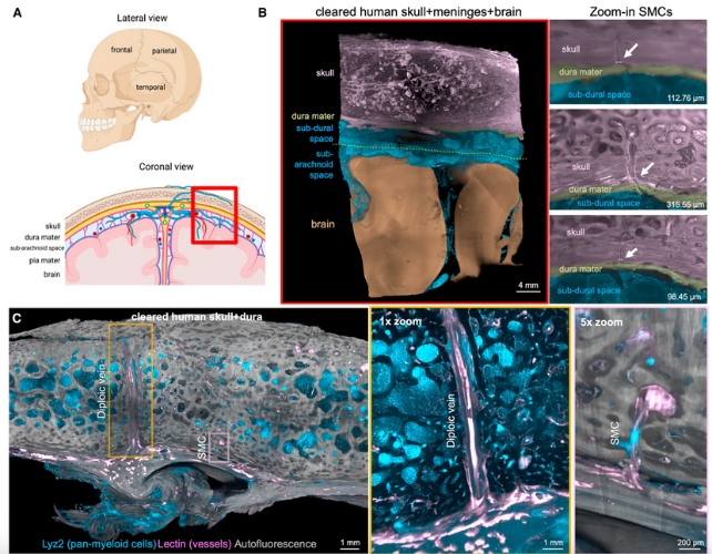 A diagram of the human brain visualized using tissue clearing.