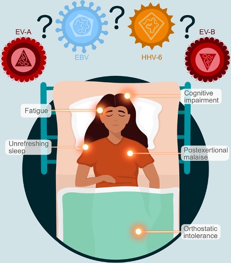 Illustration of woman lying in bed showing symptoms of chronic fatigue syndrome or ME/CFS.