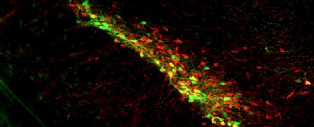 neurônios de camundongos coloridos em vermelho, amarelo e verde