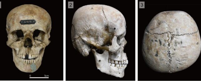 The Flattened Skulls of The Ancient Hirota People Were No Accident