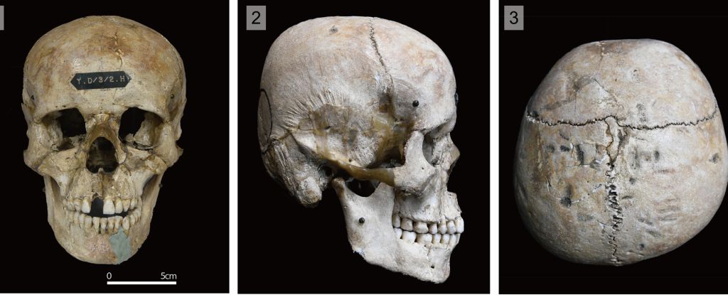 hirota skull