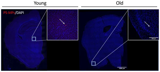 Plastic Mouse Brains