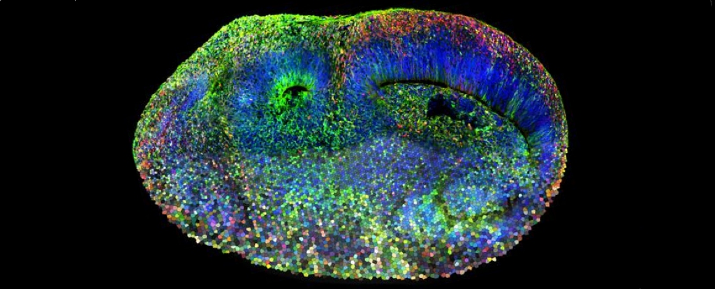 Künstliches Gehirn enthüllt genetische Ursprünge der Autismus-Spektrum-Störung: ScienceAlert